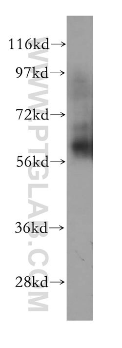 CAMKK2 Rabbit anti-Human, Mouse, Polyclonal, Proteintech:Antibodies:Primary