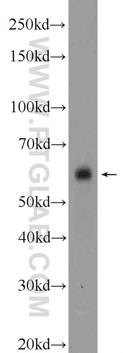 CAMKK2 Rabbit anti-Human, Mouse, Polyclonal, Proteintech:Antibodies:Primary