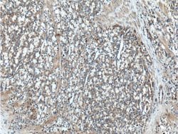 CAMKK2 Rabbit anti-Human, Mouse, Polyclonal, Proteintech:Antibodies:Primary