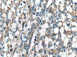 CAMKK2 Rabbit anti-Human, Mouse, Polyclonal, Proteintech:Antibodies:Primary