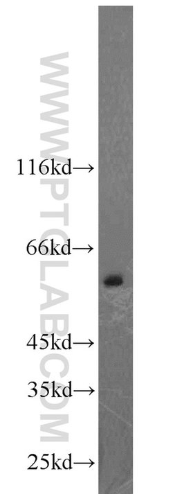 CAMKK2 Rabbit anti-Human, Mouse, Polyclonal, Proteintech:Antibodies:Primary