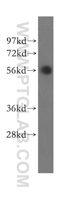 SLA/LP Rabbit anti-Human, Mouse, Rat, Polyclonal, Proteintech:Antibodies:Primary
