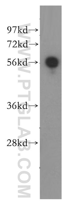 SLA/LP Rabbit anti-Human, Mouse, Rat, Polyclonal, Proteintech:Antibodies:Primary