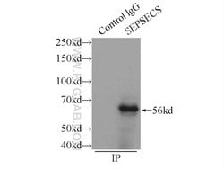 SLA/LP Rabbit anti-Human, Mouse, Rat, Polyclonal, Proteintech:Antibodies:Primary