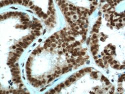 PYGO2 Rabbit anti-Human, Mouse, Rat, Polyclonal, Proteintech 20 &mu;L;