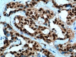 PYGO2 Rabbit anti-Human, Mouse, Rat, Polyclonal, Proteintech 20 &mu;L;