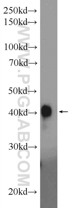 PYGO2 Rabbit anti-Human, Mouse, Rat, Polyclonal, Proteintech 20 &mu;L; Unconjugated 