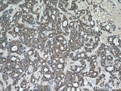ING2 Rabbit anti-Human, Mouse, Rat, Polyclonal, Proteintech 150 &mu;L;