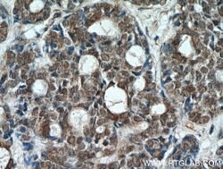 ING2 Rabbit anti-Human, Mouse, Rat, Polyclonal, Proteintech 150 &mu;L;