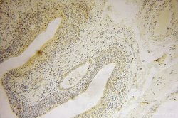 ING2 Rabbit anti-Human, Mouse, Rat, Polyclonal, Proteintech 150 &mu;L;