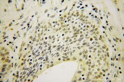 ING2 Rabbit anti-Human, Mouse, Rat, Polyclonal, Proteintech 150 &mu;L;