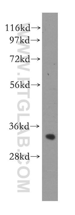 ING2 Rabbit anti-Human, Mouse, Rat, Polyclonal, Proteintech 150 &mu;L;
