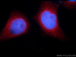 STIM1 Rabbit anti-Human, Mouse, Polyclonal, Proteintech 150 &mu;L; Unconjugated:Anticuerpos