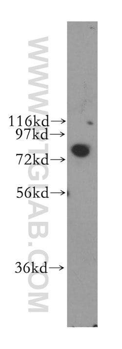 STIM1 Rabbit anti-Human, Mouse, Polyclonal, Proteintech 150 &mu;L; Unconjugated:Anticuerpos