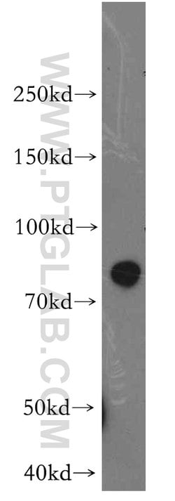 STIM1 Rabbit anti-Human, Mouse, Polyclonal, Proteintech 150 &mu;L; Unconjugated:Anticuerpos