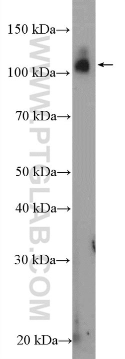 MED15 Rabbit anti-Human, Polyclonal, Proteintech 150 &mu;L; Unconjugated:Antibodies,