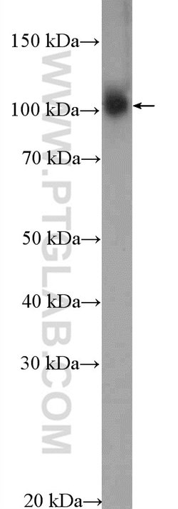 MED15 Rabbit anti-Human, Polyclonal, Proteintech 150 &mu;L; Unconjugated:Antibodies,