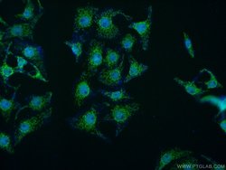 MED15 Rabbit anti-Human, Polyclonal, Proteintech 150 &mu;L; Unconjugated:Antibodies,