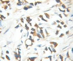 MED15 Rabbit anti-Human, Polyclonal, Proteintech 150 &mu;L; Unconjugated:Antibodies,