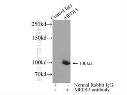 MED15 Rabbit anti-Human, Polyclonal, Proteintech 150 &mu;L; Unconjugated:Antibodies,