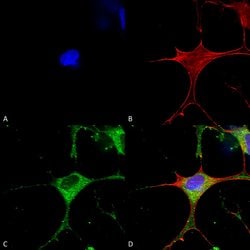 Chloride Channel Protein 3 Monoclonal Antibody (S258-5), QED Bioscience