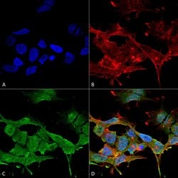 Chloride Channel Protein 3 Monoclonal Antibody (S258-5), QED Bioscience