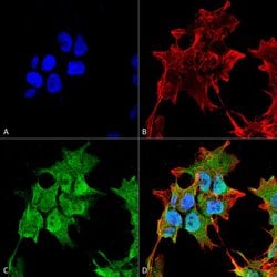SUR1 Monoclonal Antibody (S289-16), QED Bioscience 100 &mu;g; Unconjugated:Antibodies,