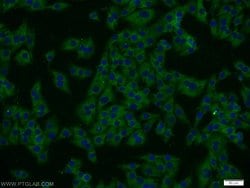 PSMA6 Rabbit anti-Human, Mouse, Rat, Polyclonal, Proteintech:Antibodies:Primary