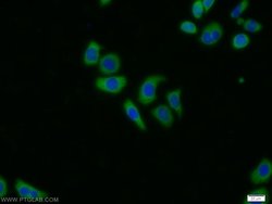 PSMA6 Rabbit anti-Human, Mouse, Rat, Polyclonal, Proteintech:Antibodies:Primary