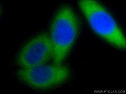 PSMA6 Rabbit anti-Human, Mouse, Rat, Polyclonal, Proteintech:Antibodies:Primary