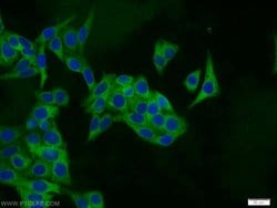 PSMA6 Rabbit anti-Human, Mouse, Rat, Polyclonal, Proteintech:Antibodies:Primary
