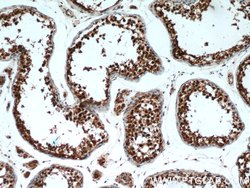 PSMA6 Rabbit anti-Human, Mouse, Rat, Polyclonal, Proteintech:Antibodies:Primary