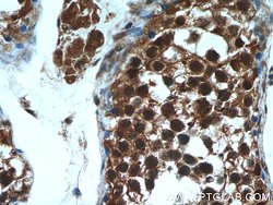 PSMA6 Rabbit anti-Human, Mouse, Rat, Polyclonal, Proteintech:Antibodies:Primary