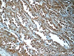 PSMA6 Rabbit anti-Human, Mouse, Rat, Polyclonal, Proteintech:Antibodies:Primary