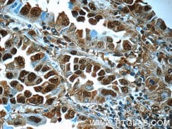 PSMA6 Rabbit anti-Human, Mouse, Rat, Polyclonal, Proteintech:Antibodies:Primary