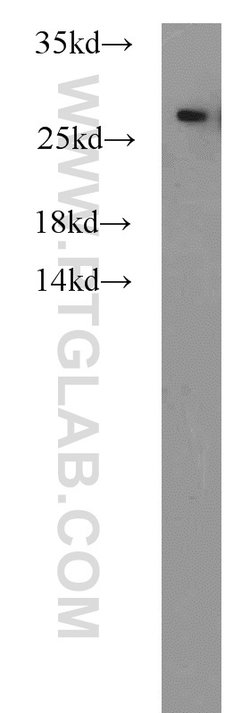 PSMA6 Rabbit anti-Human, Mouse, Rat, Polyclonal, Proteintech:Antibodies:Primary