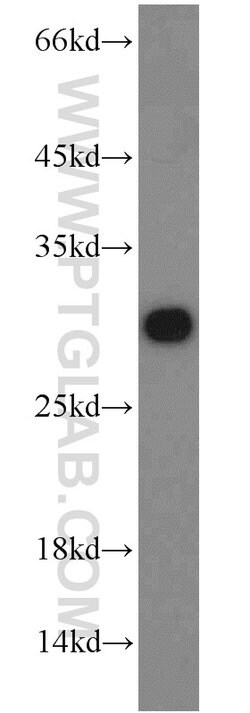 PSMA6 Rabbit anti-Human, Mouse, Rat, Polyclonal, Proteintech:Antibodies:Primary
