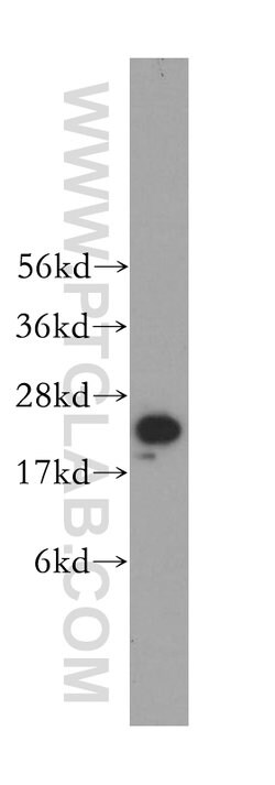 PSMA6 Rabbit anti-Human, Mouse, Rat, Polyclonal, Proteintech:Antibodies:Primary