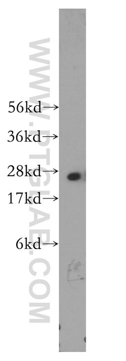 PSMA6 Rabbit anti-Human, Mouse, Rat, Polyclonal, Proteintech:Antibodies:Primary