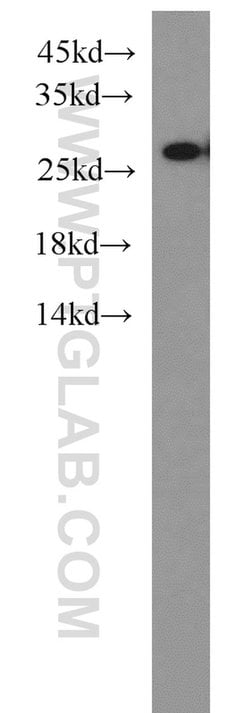 PSMA6 Rabbit anti-Human, Mouse, Rat, Polyclonal, Proteintech:Antibodies:Primary