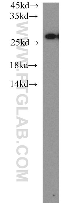 PSMA6 Rabbit anti-Human, Mouse, Rat, Polyclonal, Proteintech:Antibodies:Primary