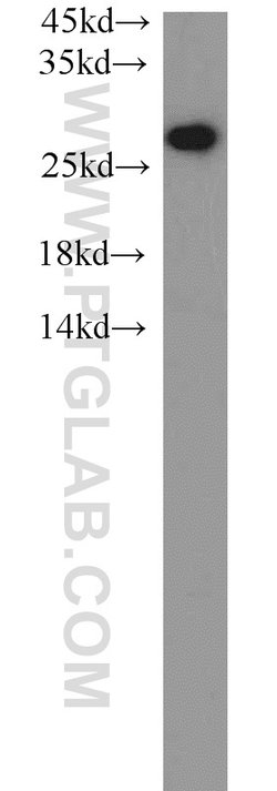 PSMA6 Rabbit anti-Human, Mouse, Rat, Polyclonal, Proteintech:Antibodies:Primary