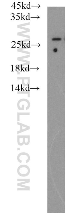 PSMA6 Rabbit anti-Human, Mouse, Rat, Polyclonal, Proteintech:Antibodies:Primary