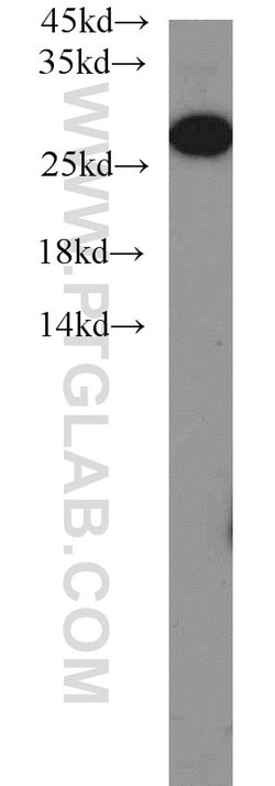 PSMA6 Rabbit anti-Human, Mouse, Rat, Polyclonal, Proteintech:Antibodies:Primary