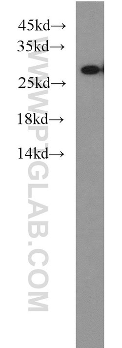 PSMA6 Rabbit anti-Human, Mouse, Rat, Polyclonal, Proteintech:Antibodies:Primary