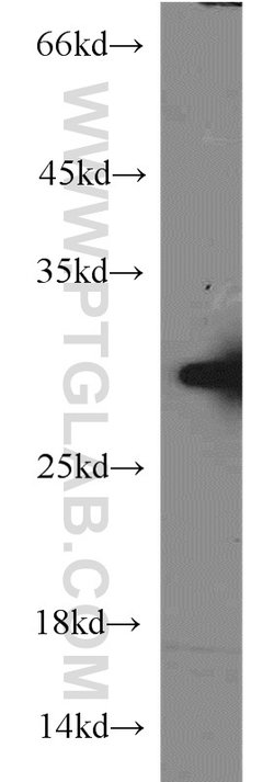 PSMA6 Rabbit anti-Human, Mouse, Rat, Polyclonal, Proteintech:Antibodies:Primary