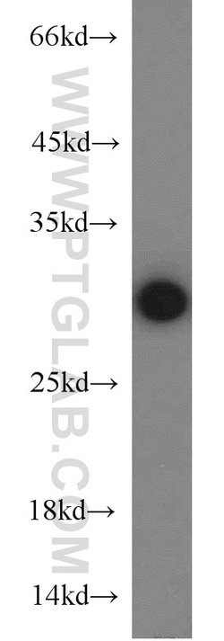 PSMA6 Rabbit anti-Human, Mouse, Rat, Polyclonal, Proteintech:Antibodies:Primary