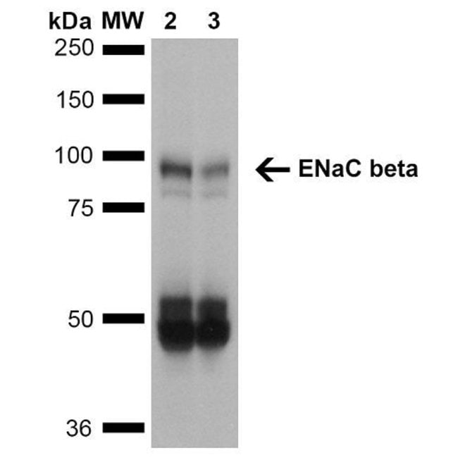 ENaC beta Monoclonal Antibody (16E4), QED Bioscience 100 μg; UnconjugatedAntibodies, Fisher