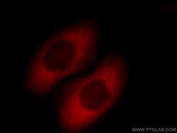 SCIN Rabbit anti-Human, Mouse, Rat, Polyclonal, Proteintech 150 &mu;L;