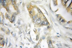 SCIN Rabbit anti-Human, Mouse, Rat, Polyclonal, Proteintech 150 &mu;L;
